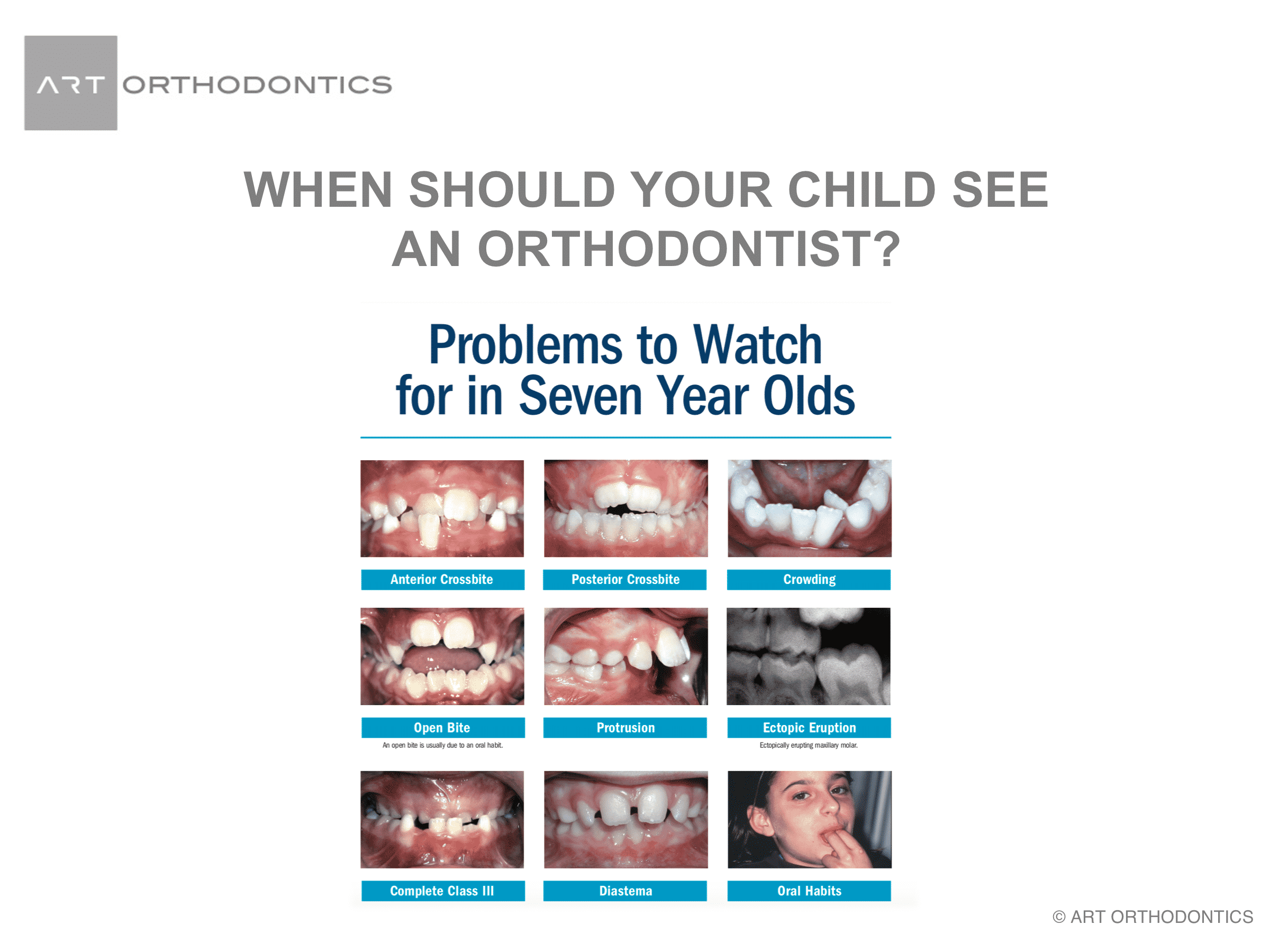 Nine reasons why 7 year olds should see an orthocdontist