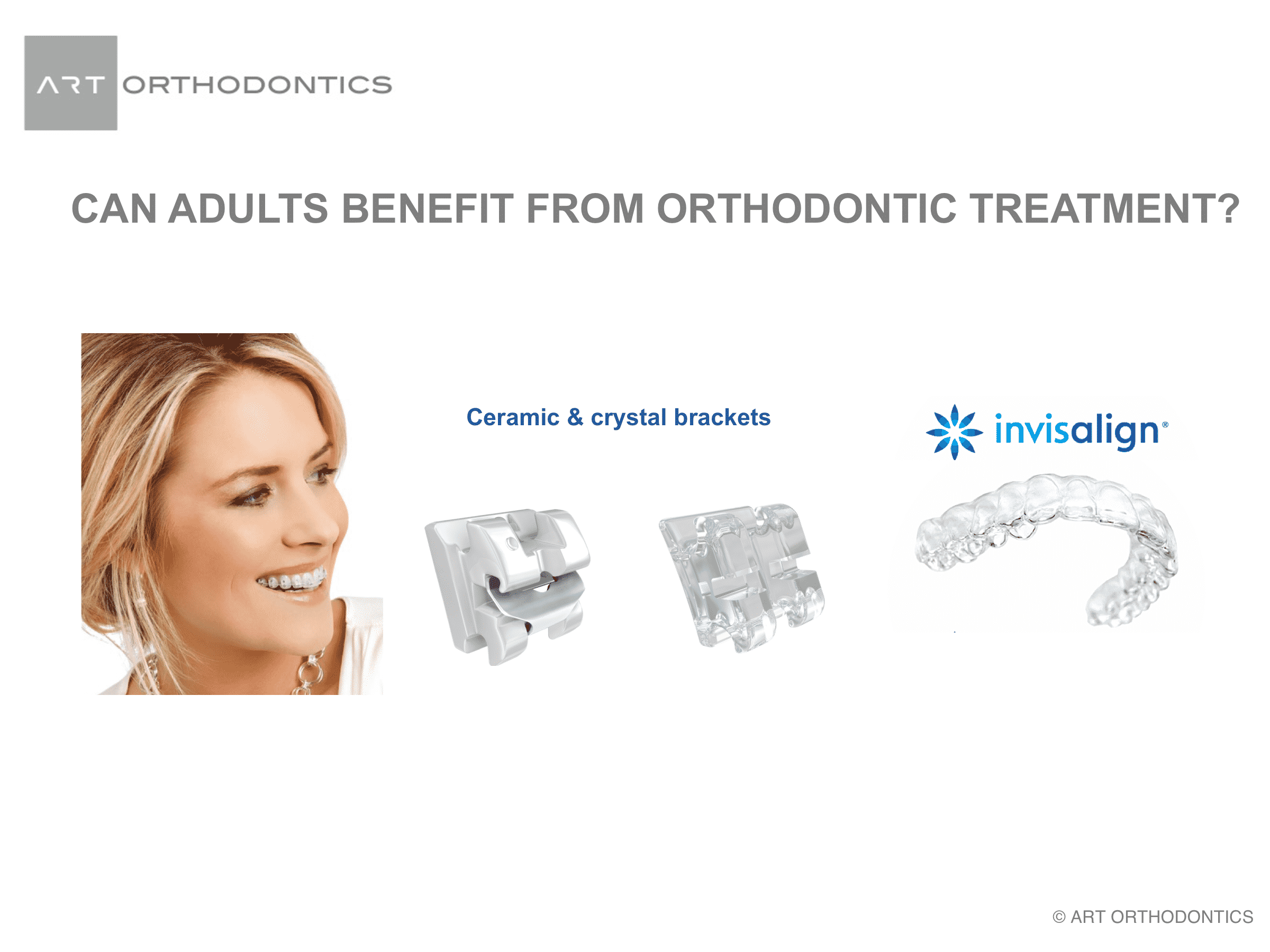 Brackets transparentes e invisalign para el tratamiento de pacientes adultos.