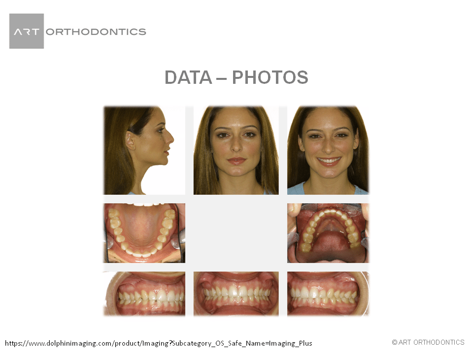 Composite photos of patient