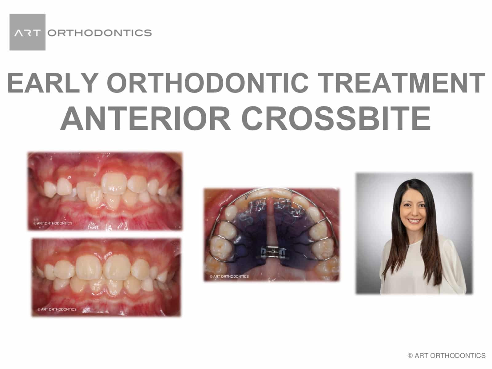 Tratamiento de ortodoncia precoz Introducción Diapositiva Dr. Khatami