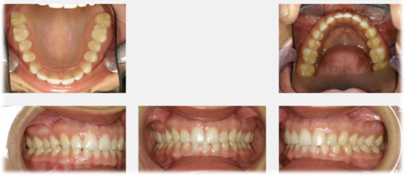 Demonstration Images of the Dental Arches