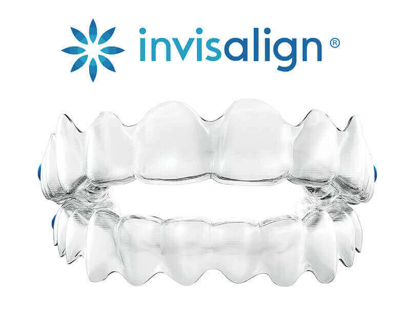 Invisalign Clear Trays